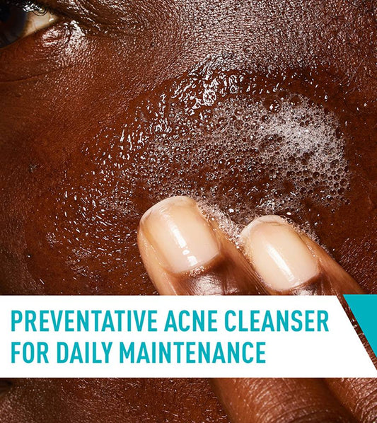 CeraVe Acne Control Cleanser 237ml – 2% Salicylic Acid Face Wash (USA)