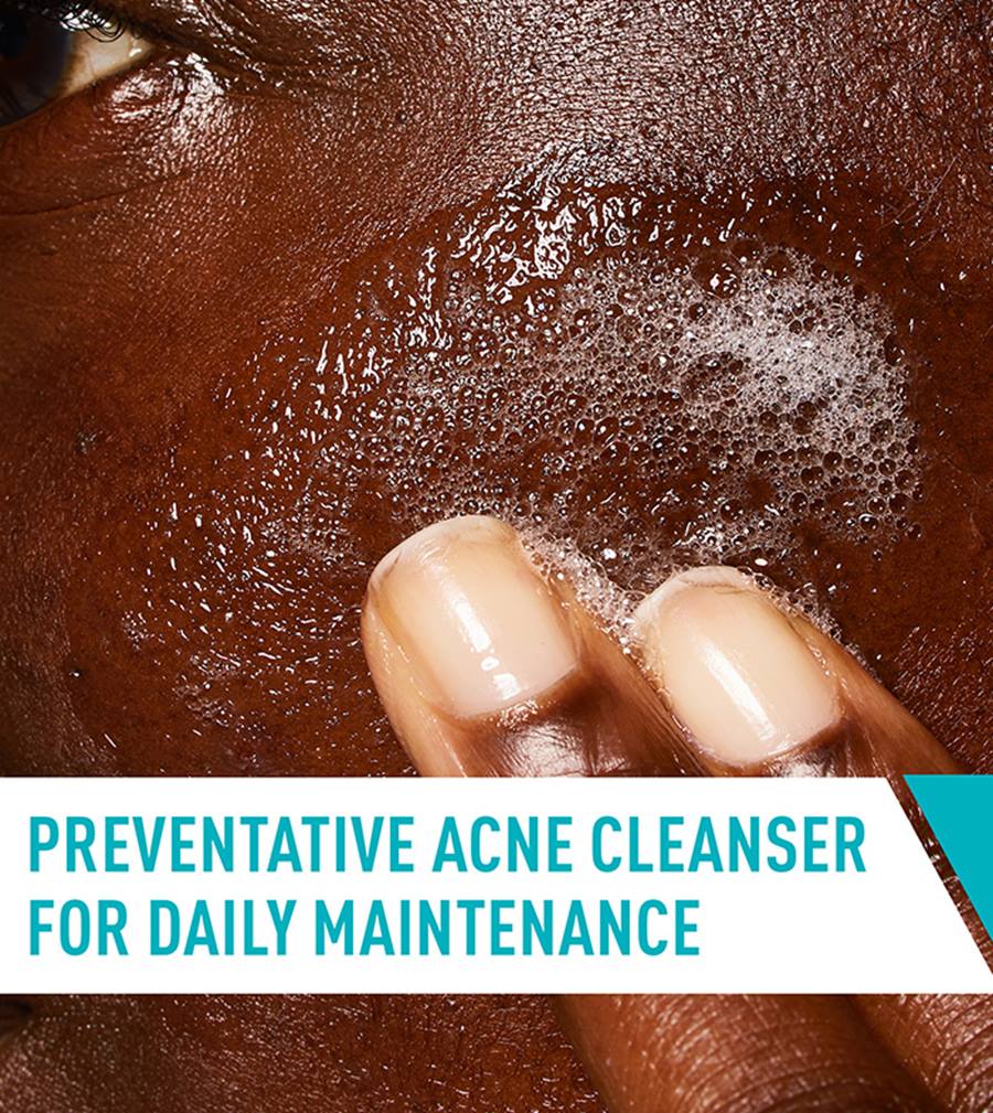 CeraVe Acne Control Cleanser 237ml – 2% Salicylic Acid Face Wash (USA)